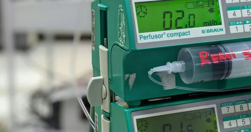 Dialysis infusion pump equipment in a clinical treatment room, representing dialysis vascular access billing